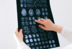 Power of Predictive Analytics in Early Disease Detection